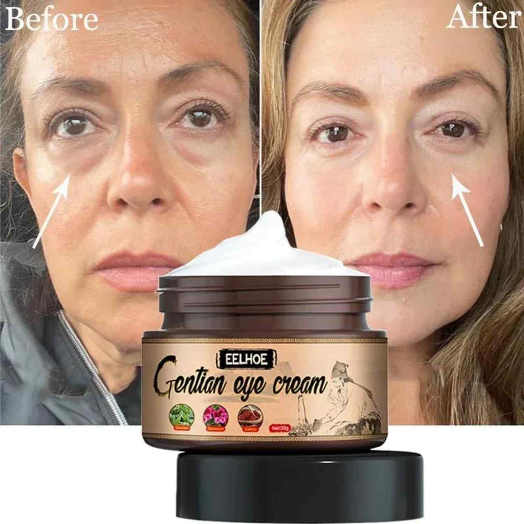 Eyes Cream (Reduce under eye bags)