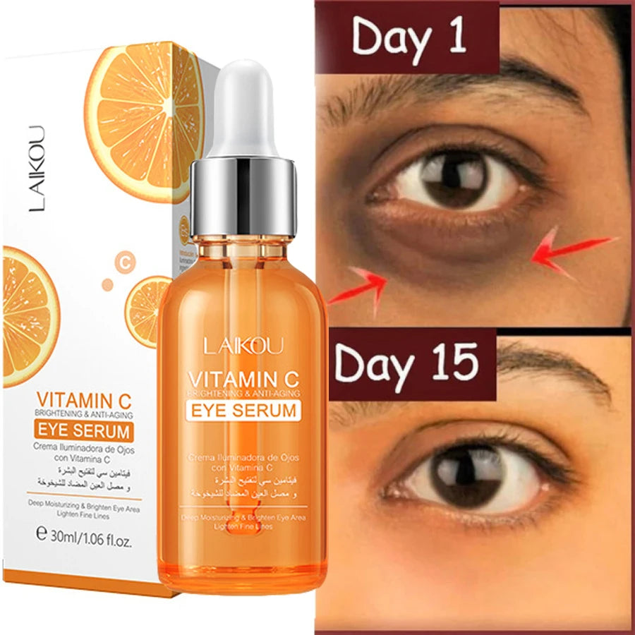 Vitamin C Dark Circle Remover