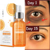 Vitamin C Dark Circle Remover