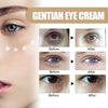Eyes Cream (Reduce under eye bags)