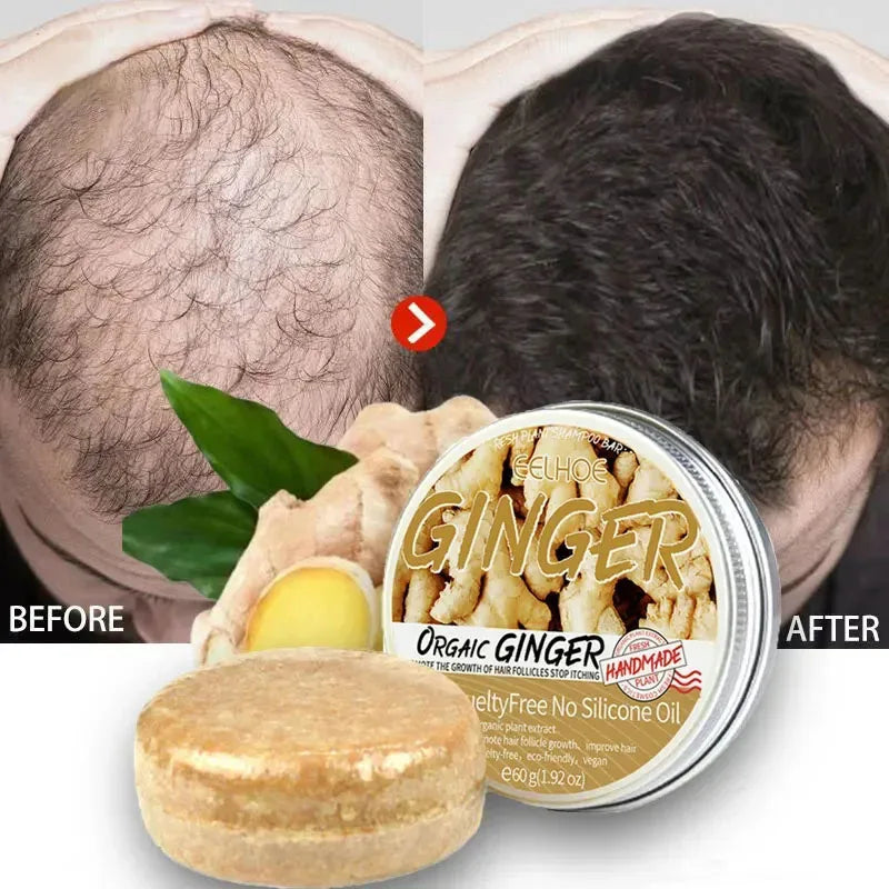 Ginger Hair Growth Soap Fast Growing Anti Hair Loss Product