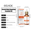 Stretch Marks Treatment Repair