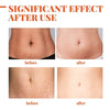 Stretch Marks Treatment Repair