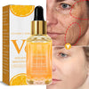 Vitamin C Whitening Serum (Dark Spot Corrector)