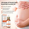Stretch Marks Treatment Repair