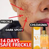 Vitamin C Whitening Serum (Dark Spot Corrector)