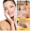 Kojic Acid Skin Care Set Facial Cleanser & Body Lotion