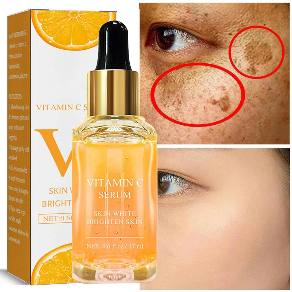 Vitamin C Whitening Serum (Dark Spot Corrector)