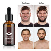 4pcs/set Beard Growth Kit