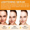 Vitamin C Serum (Dark Spot Corrector)