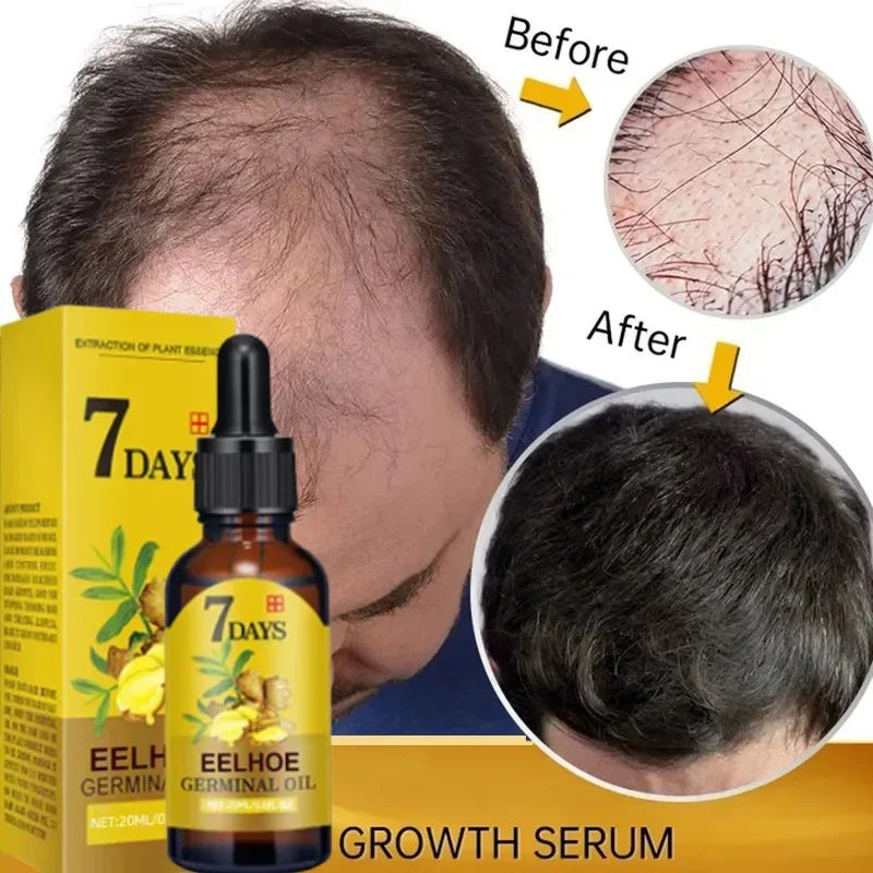 Ginger Fast Hair Growth Serum Oil for Man