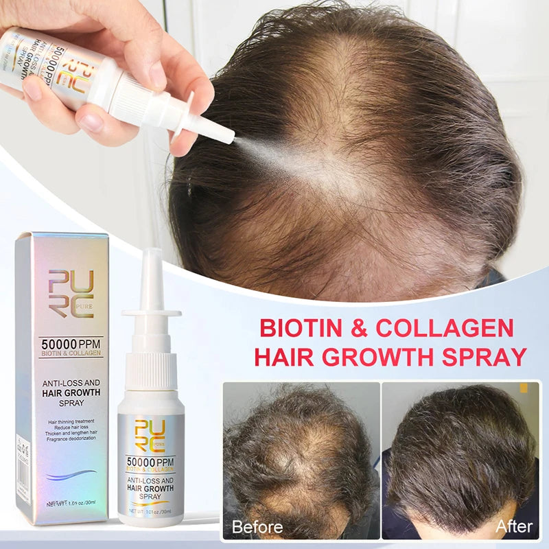 Biotin & Collagen hair Growth Spray