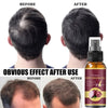 Powerful Hair Growth Serum Spray