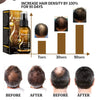 IBeaLee Biotin Anti Hair Loss Spray 1/2/3pcs Scalp Treatment Product
